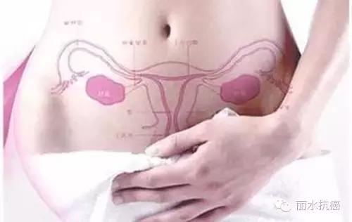 卵巢癌的病因,卵巢癌的病因及预防方法