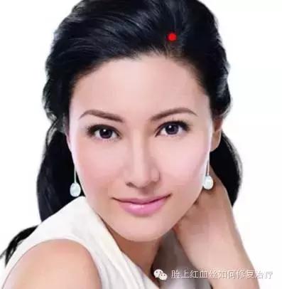 脸颊红血丝怎么消除,脸颊红血丝怎么去除小妙招