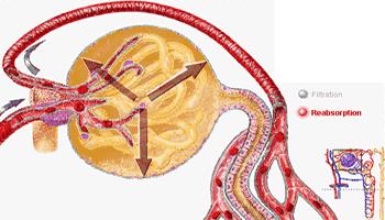 肾病患者适合干什么工作,肾病可以上班吗