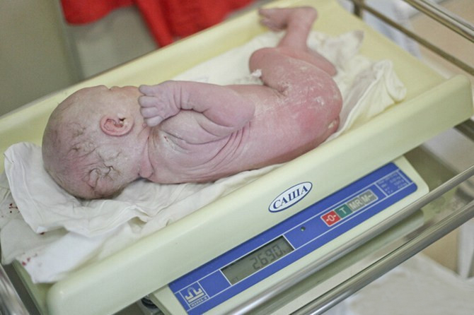 院长剖腹产,剖腹产后医生必做的几件事