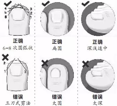 跑步1000米岔气怎么办,5步解决跑步黑指甲