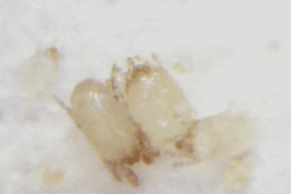 孩子感冒喷嚏不停,孩子感冒咳嗽还频繁打喷嚏