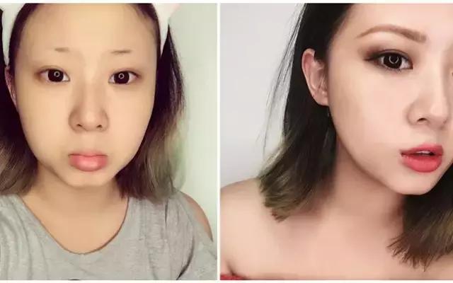 不用整容使鼻子变高挺,鼻子变高整容