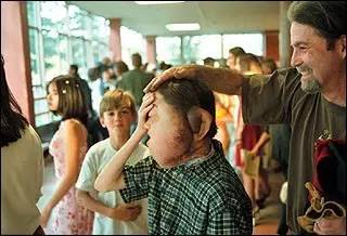 这个十四岁男孩，决定切掉自己的左脸