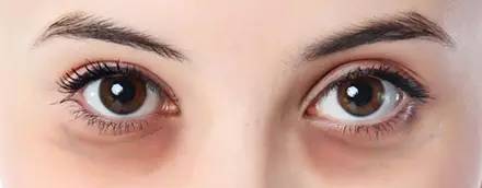 40岁眼周适合用什么样的眼霜,眼周发黑适合用什么眼霜