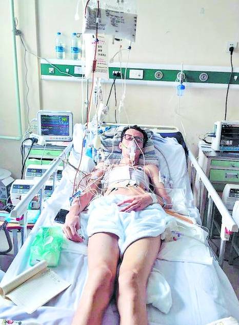 手长脚长似“蜘蛛人”，肇东一姐弟26岁“准时”发病，基因来自35岁去世的妈妈