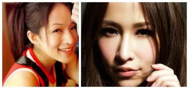 不用整容使鼻子变高挺,鼻子变高整容