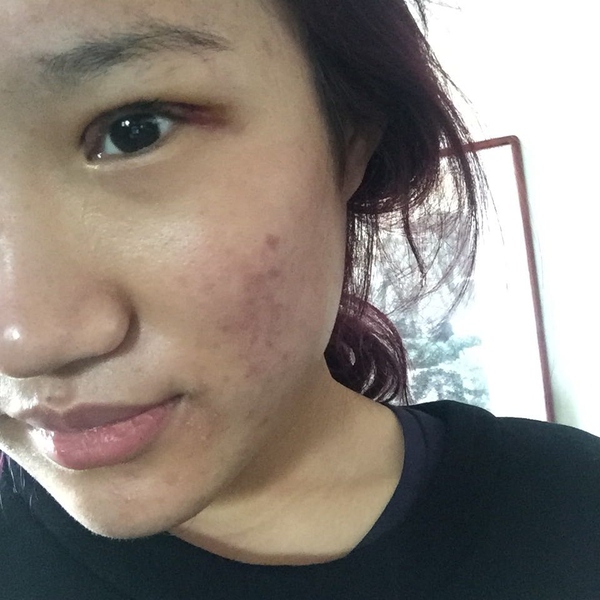 爸爸是直男癌，我割了双眼皮都不让抱了！