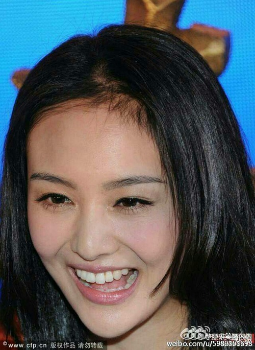 整容后遗症眼眨嘴歪,整容后遗症脸歪鼻子歪