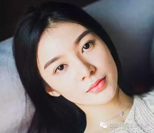 眼底激光光凝术术后护理,激光美容祛斑术后护理