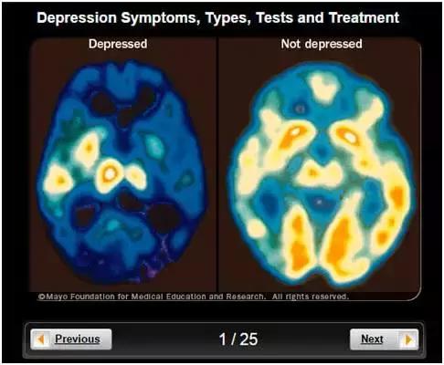 如果你身边人抑郁了，请别只说“想开点”