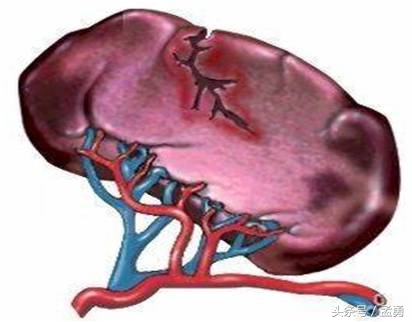 老王到医院看病案例,老王车祸