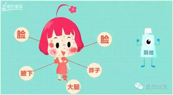 治疗慢性湿疹有什么好的偏方吗,100个神奇偏方治湿疹荨麻疹