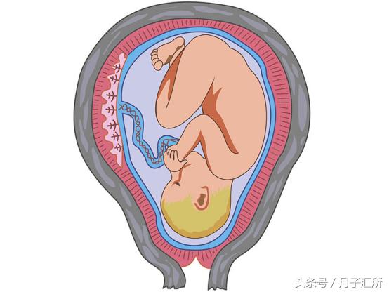 耻骨联合分离生完孩子多久能好,生完娃耻骨分离1.78厘米