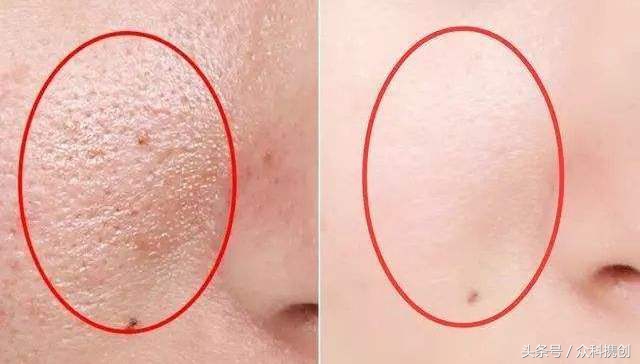 火山泥真的能清洁毛孔吗,用火山泥洗脸再用洗面奶