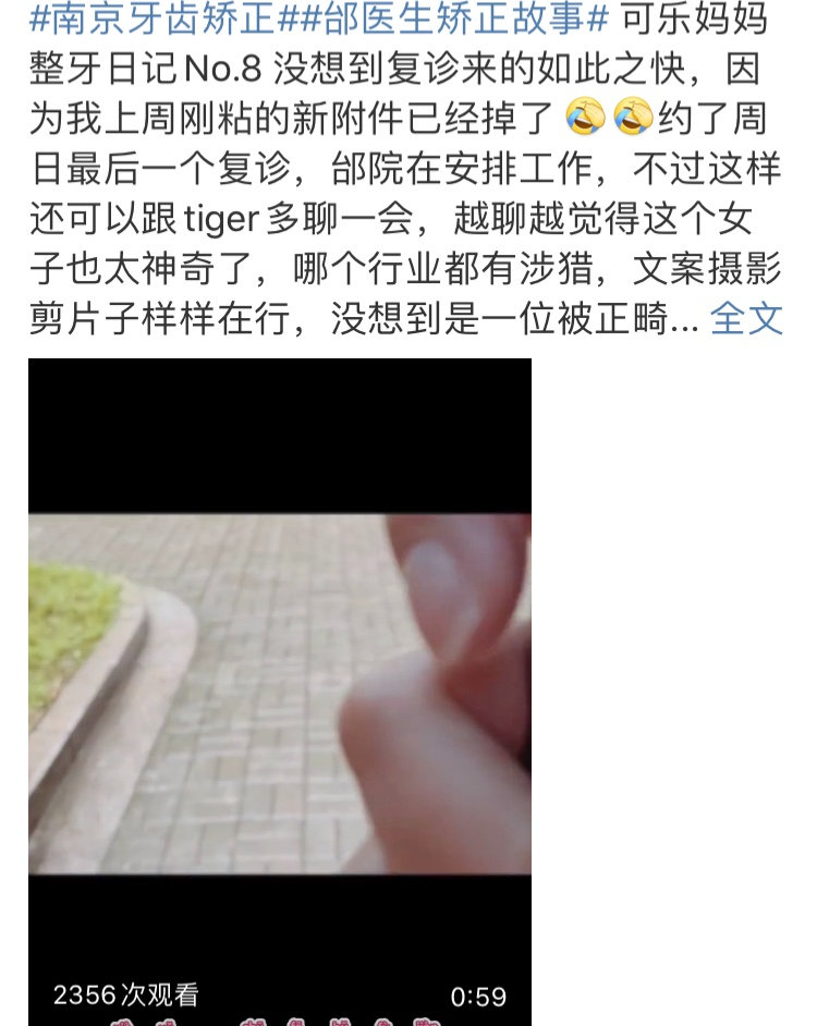 正畸医生邰怡的作品,南京牙齿矫正邰医生