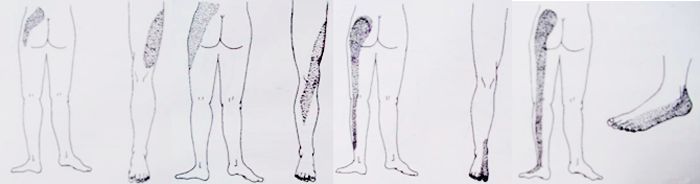 腰椎病的防治中医知识,腰椎病防治小常识书