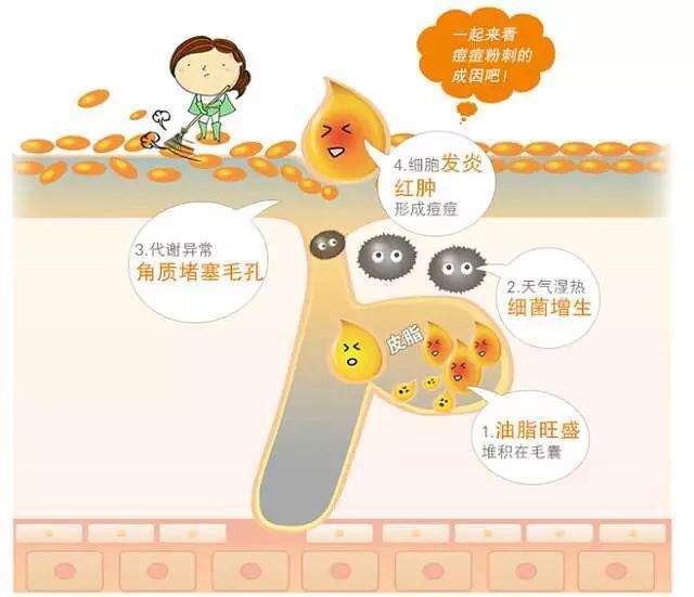 男生如何祛痘痘,男生怎么祛痘痘和痘印