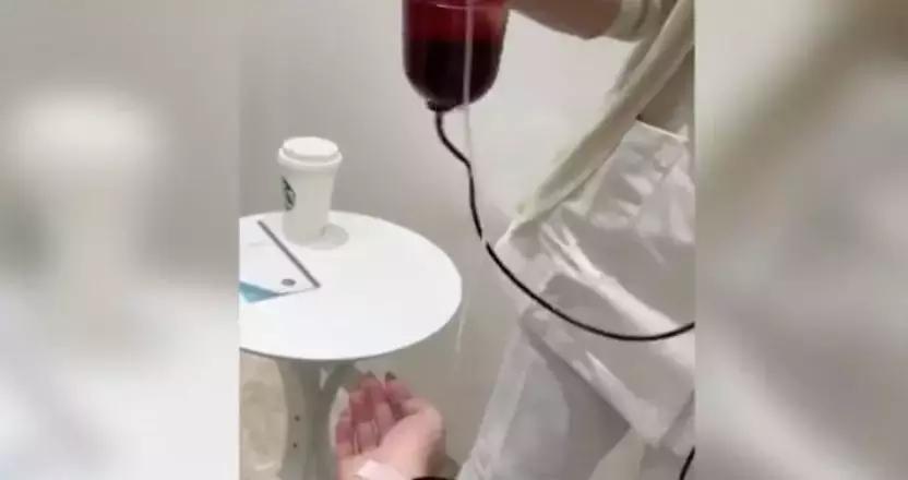 减肥出大事!用了网上爆红的方法,23岁姑娘紧急“换肝”捡回一条命