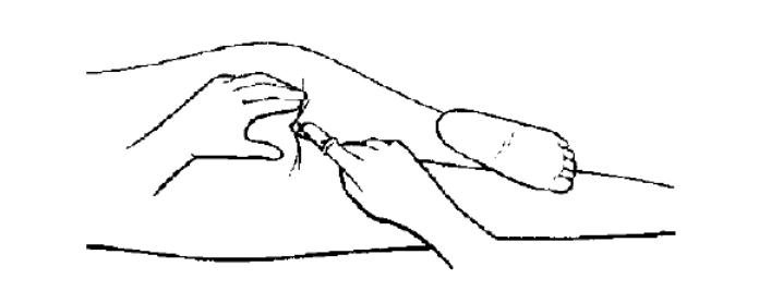 发烧正确用退热药方法,儿童退热药合理使用方法