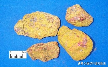 中药中杀虫止痒药速记口诀,杀虫止痒中医医案