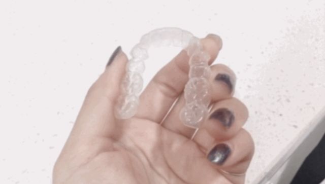 现在矫正牙技术成熟吗,矫正牙齿不要花冤枉钱