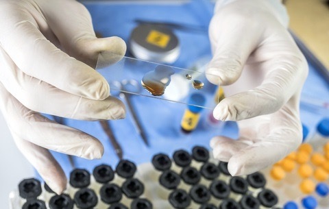 男子器官移植后9个月死亡,美国男子做移植手术