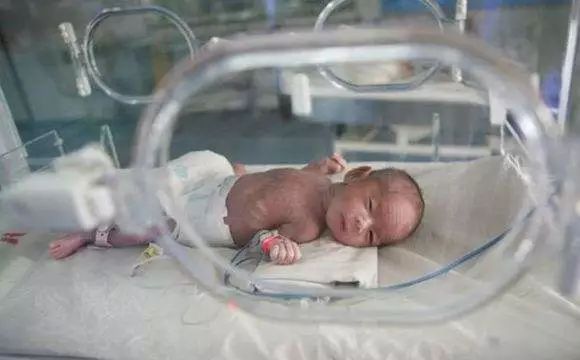 早产儿一般早产多久才是危险,早产后注意事项有哪些