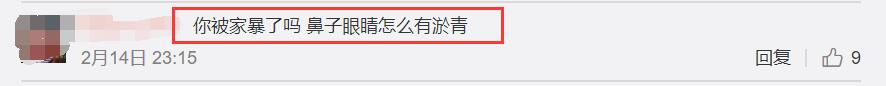 林志玲情人节录视频，鼻子部位疑似有淤青，评论区现神评论