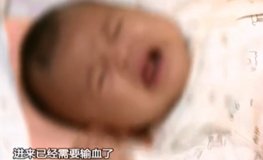 女婴出生50天脑出血,男婴出生月余突发脑出血