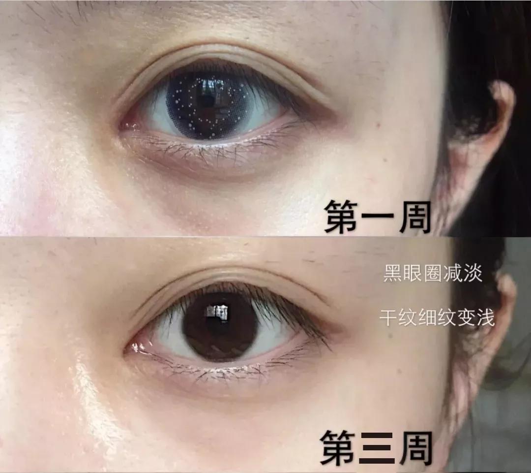 眼霜到底有没有用啊,眼霜里面有什么成分不能用