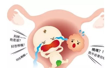 阴道炎引起早产,阴道炎会引起孕妇胎膜早破吗