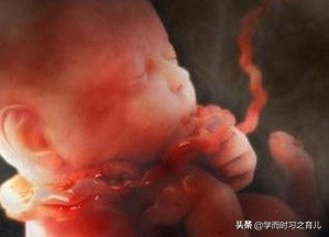 孕妇须知：脐带异常的5种情况和危险，准妈妈做好这些，别慌张