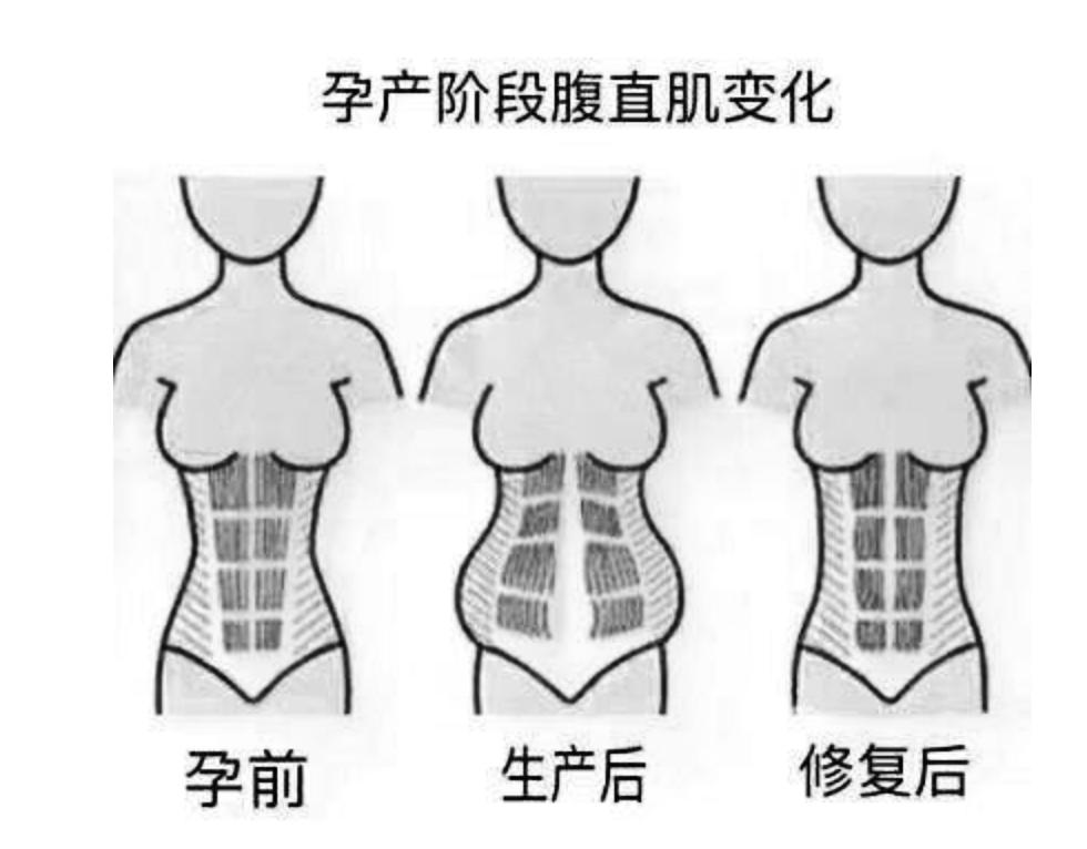 产后妈妈的痛谁能够理解？