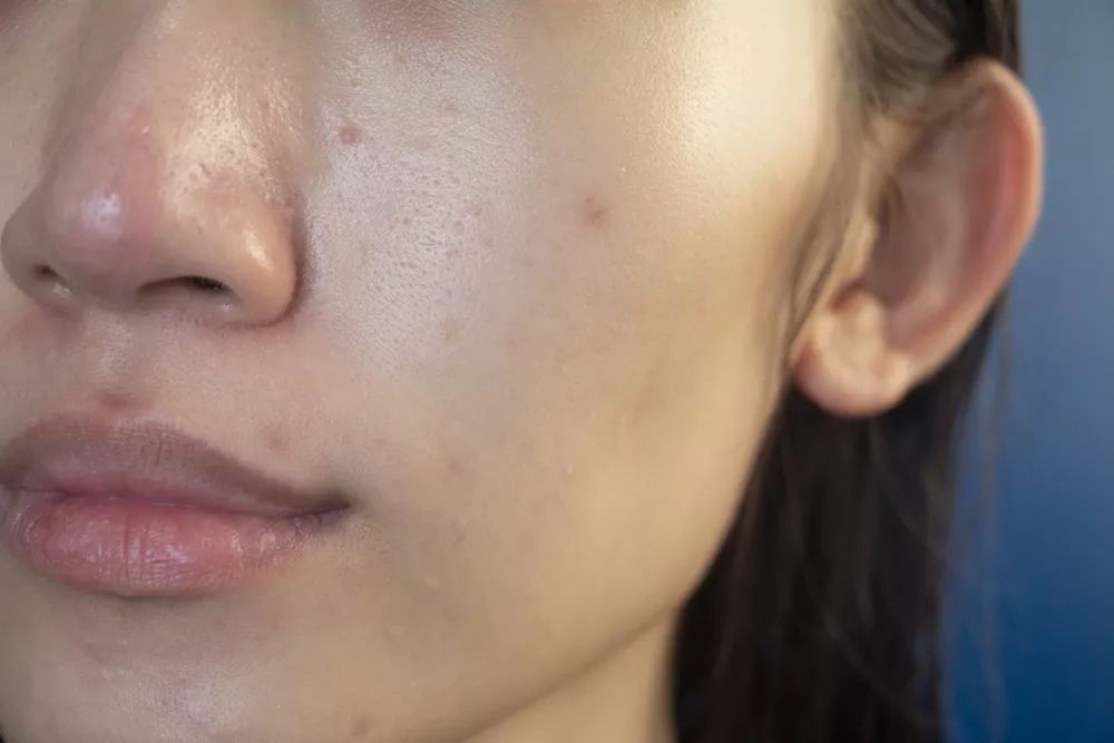 我用空瓶了几十瓶面霜的经验告诉你,谁才是真正的干皮亲妈