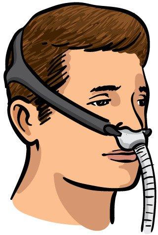 治疗打鼾的呼吸机怎么使用,呼吸机治打鼾效果怎么样