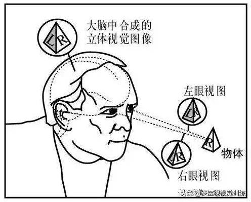 弱视单眼抑制做什么训练,弱视训练立体视是最后一步吗