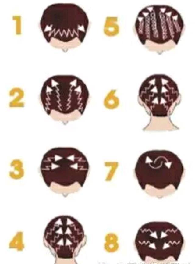 脱发秃顶严重怎么调理男,男士怎么防脱发秃顶