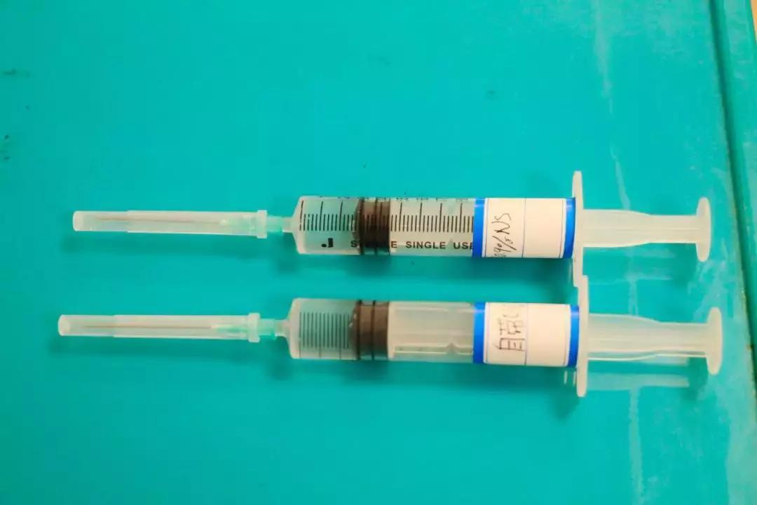 picc堵管了直接拔掉可以吗,化疗用的picc管堵了什么原因