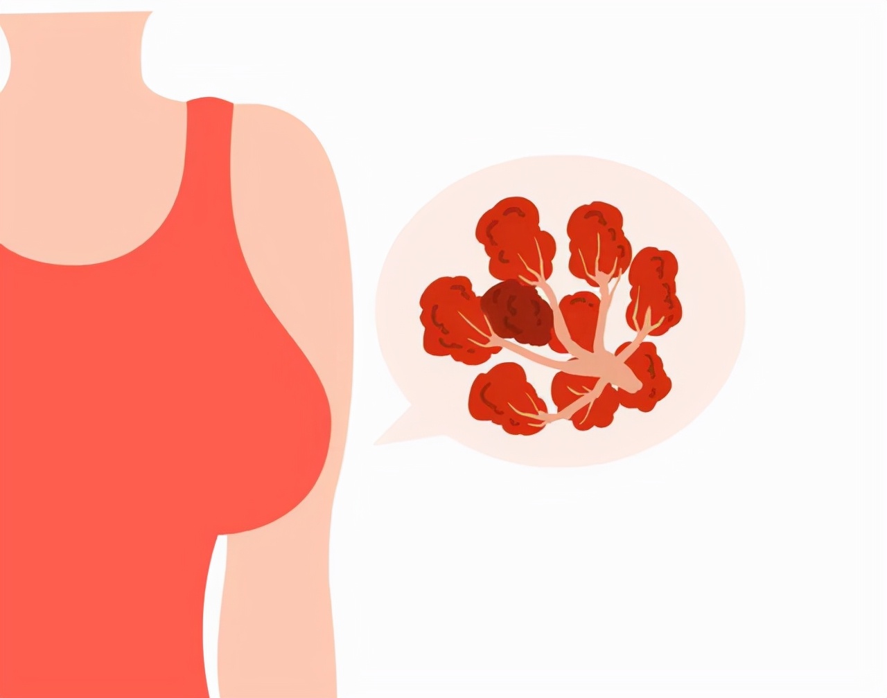 钙化是否说明病已好了,如何知道钙化呈现什么形状