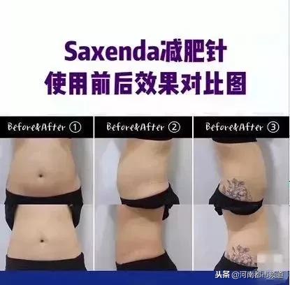 网红减肥神器最有效最快的,不运动不节食不反弹懒人减肥必备