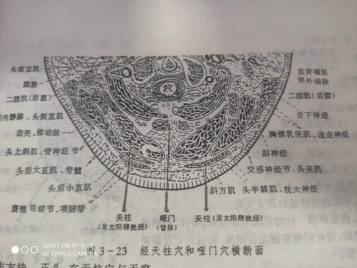 哑门穴针刺多深能致哑,哑门穴针刺有危险吗