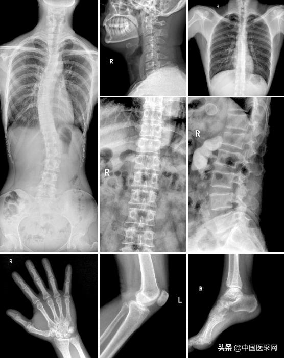 安健科技最新消息,安健科技新品