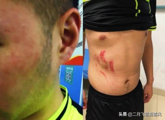 成都篮球裁判被殴打,足球球迷殴打裁判