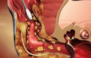 猫咪有一只耳朵很多黑色分泌物,猫咪耳朵褐色分泌物