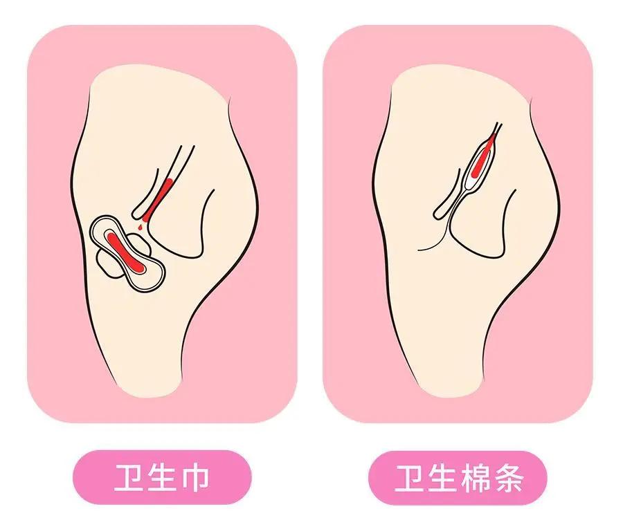 姨妈巾和卫生棉条哪个好用,卫生巾和卫生棉条哪款好用