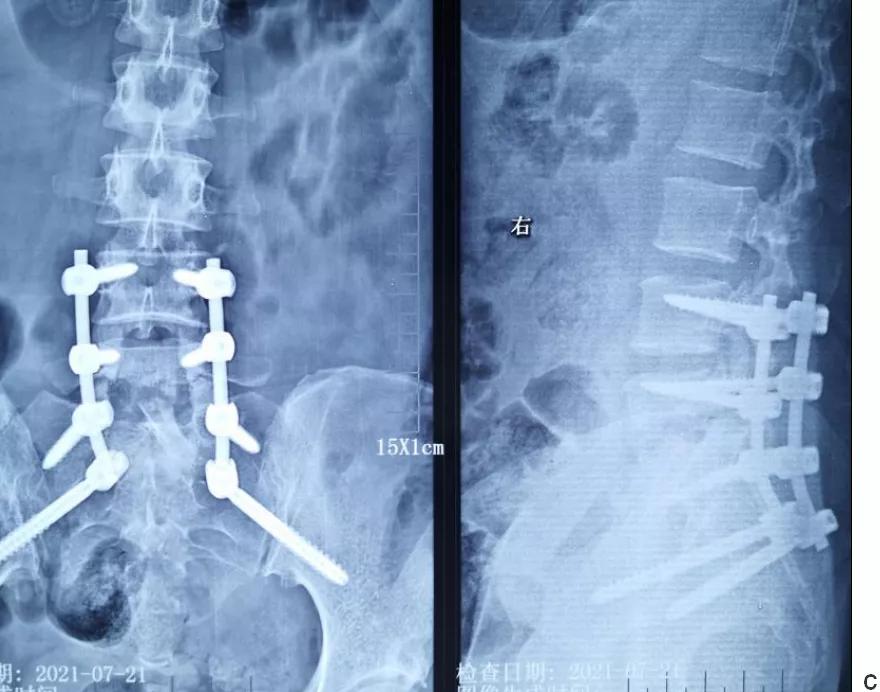 唐都医院脊柱科廖博,脊柱外科医生廖博