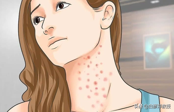 皮肤科医生眼中的真相,皮肤科激素皮炎