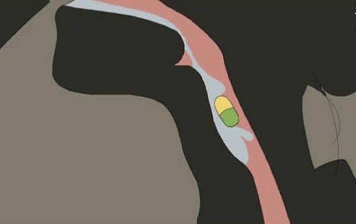 二次元吃药,二次元吞下1000片药物