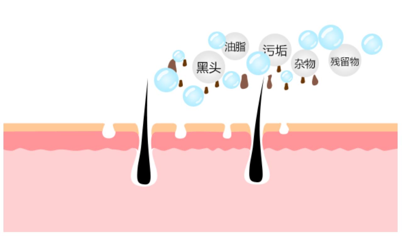 额头闭口反反复复怎么办,额头反反复复长闭口粉刺怎么办